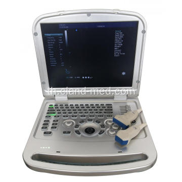 แล็ปท็อปที่มีคุณภาพสูง 4d แบบพกพาสี Doppler เครื่องอัลตราซาวด์